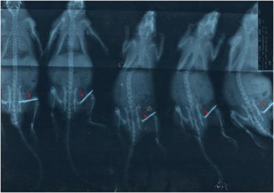 The Effect of a Local Injection of Flurbiprofen Ester Microspheres on Systemic Inflammatory Model Rats With a Closed Femoral Shaft Fracture